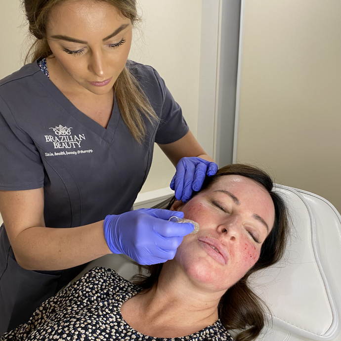 Boost Your Beauty Game:  The new OMG treatment that will give your skin clinic a megawatt glow.