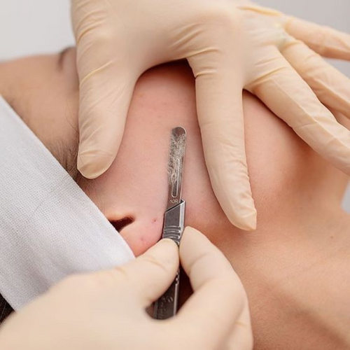 Dermaplaning | In-person